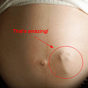 PregnantBellyAndFootAnnotated